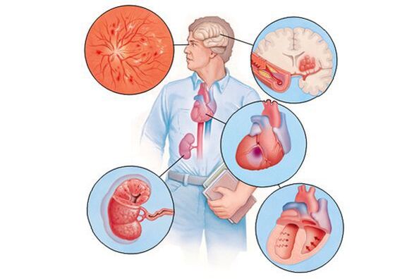 Danos a varios órganos con hipertensión arterial prolongada