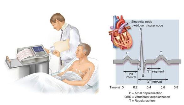 Electrocardiografía para detectar enfermidades cardiovasculares con hipertensión